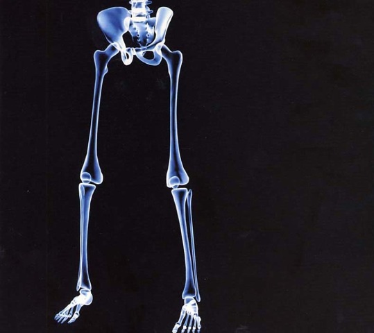 Musculoskeletal Radiology (The Lower Limb)