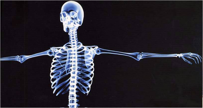 Musculoskeletal Radiology